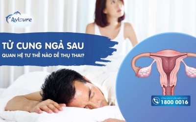 Tử cung ngả sau nên quan hệ tư thế nào dễ thụ thai?